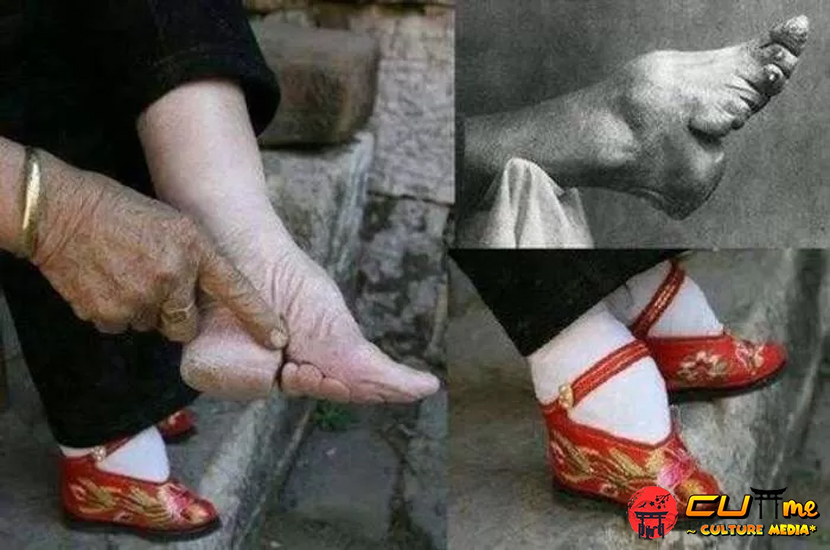 Ikat Kaki Penyiksaan Kecil yang Menyeramkan di Budaya China